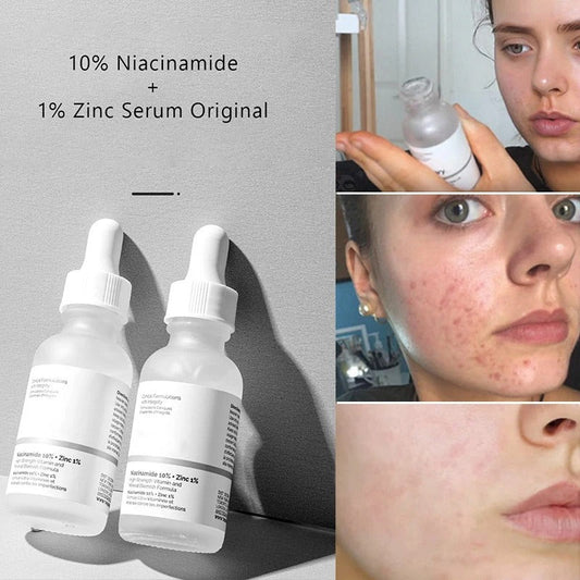 The Ordinary Niacinamide 10% Serum